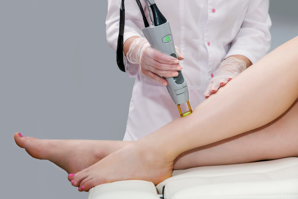Laser Hair Removal in Queens