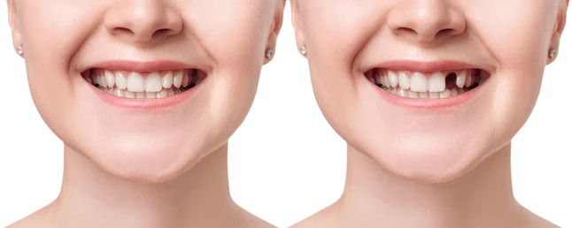 How Preventive Dental Care in 2026 Can Save You Time and Money