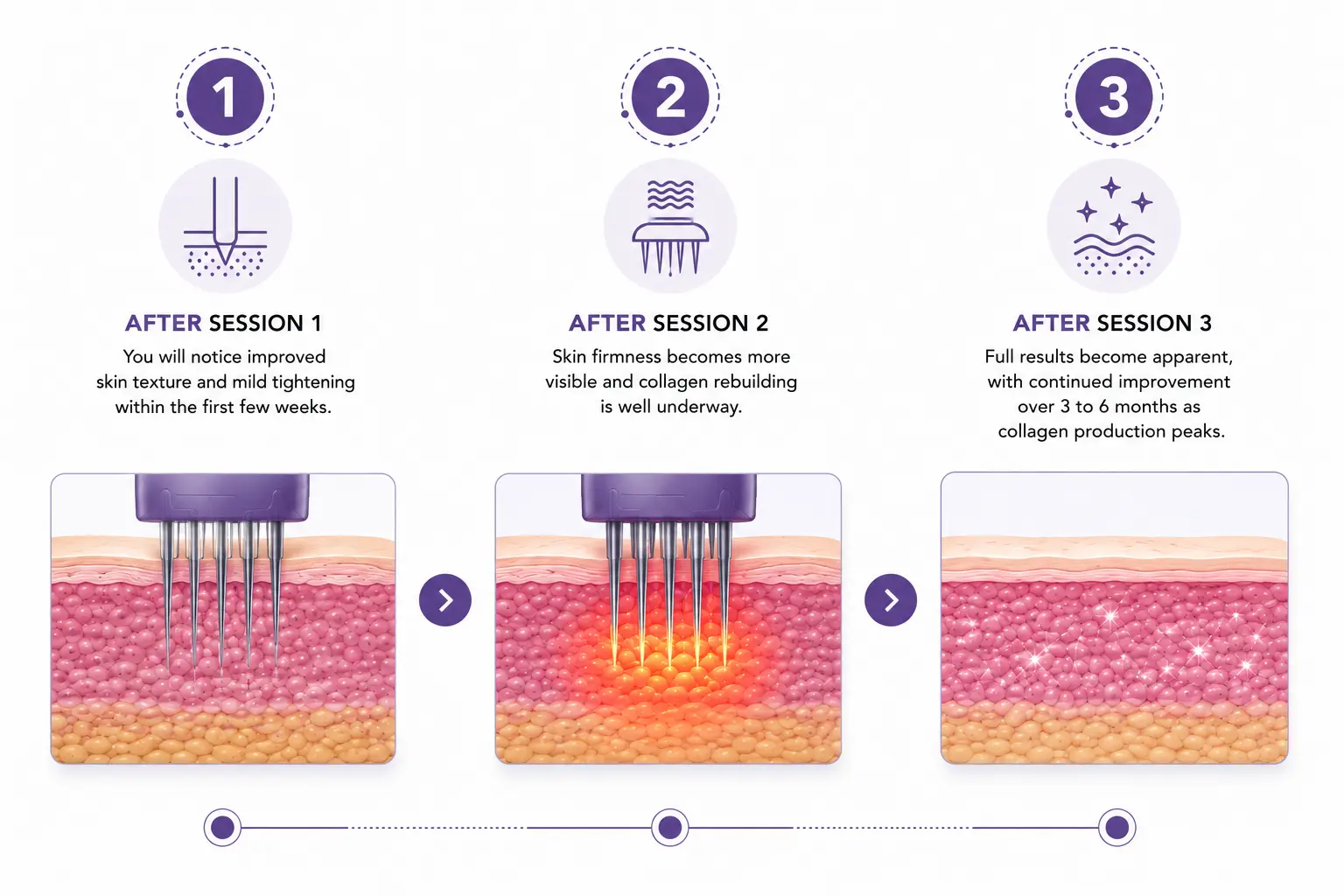 skin tightening in Forest Hills
